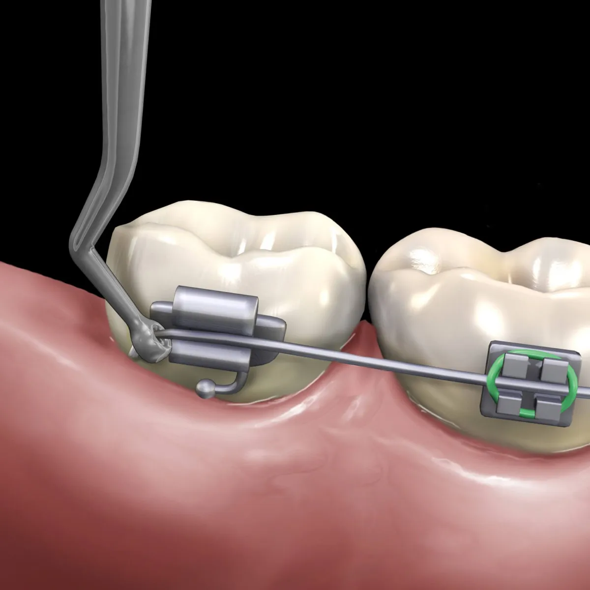 GDC Distal Bending Instrument 75.0mm/ 55.0mm (2815) — Teethment catalog guide